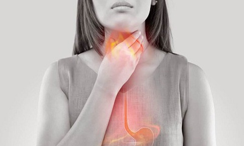 Ợ nóng có thể cảnh báo nguy cơ ung thư ruột