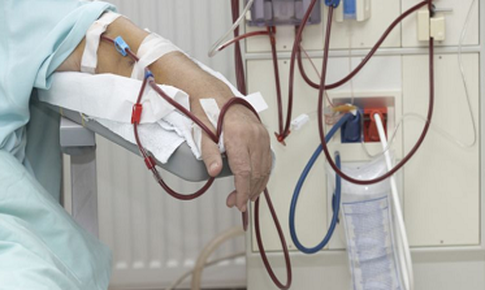 COVID-19 có thể làm tăng chi phí cho bệnh thận