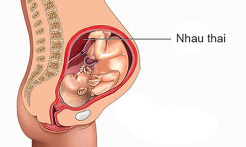 C&#225;c chất g&#226;y &#244; nhiễm kh&#244;ng kh&#237; c&#243; thể tiếp cận đến nhau thai