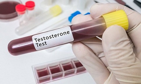 Testosterone thấp l&#224;m tăng nguy cơ mắc COVID-19 nghi&#234;m trọng ở nam giới