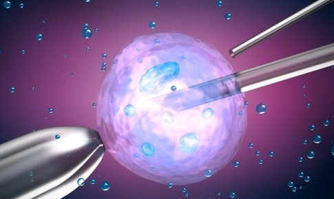 Nhiều bác sĩ chữa hiếm muộn bị kiện vì đánh tráo tinh trùng