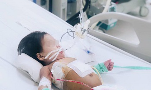 Sốc: B&#233; g&#225;i 10 th&#225;ng tuổi thủng thực quản, phổi kh&#225;ng tất cả kh&#225;ng sinh
