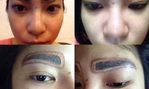 Cần sớm có quy chế về phạm vi hoạt động của phẫu thuật thẩm mỹ