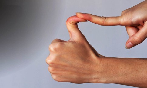 Hội chứng ehlers-danlos: Nguyên nhân, biểu hiện, cách điều trị và phòng bệnh