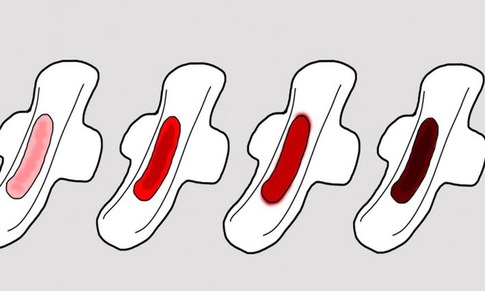 Hiện tượng kinh nguyệt màu đen có đáng lo ngại?