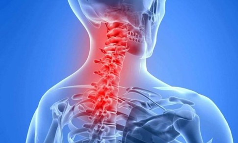 Đau cổ vai gáy có nguy hiểm, khi nào là bệnh lý phải nhập viện?