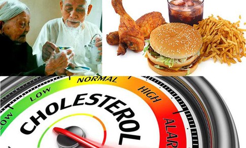 Xơ vữa động mạch: Bệnh lý nguy hiểm nhưng dễ bị bỏ qua