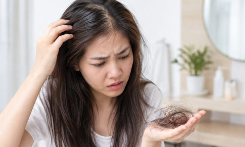 Viêm da tiết bã có gây rụng tóc?