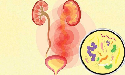 Nhiễm khuẩn tiết niệu có biểu hiện như thế nào?