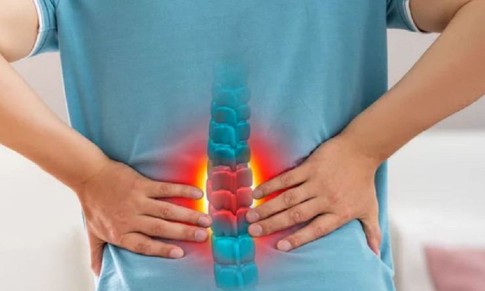 Đau lưng âm ỉ là dấu hiệu cảnh báo những bệnh gì?