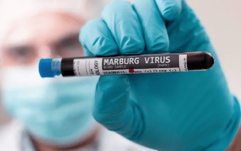 Chủ động gi&#225;m s&#225;t, ph&#225;t hiện v&#224; kiểm so&#225;t bệnh do virus Marburg