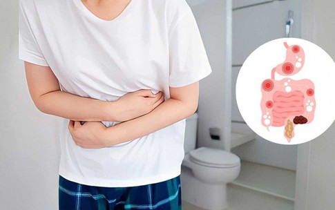 Lưu &#253; khi d&#249;ng mebeverine trị hội chứng ruột k&#237;ch th&#237;ch