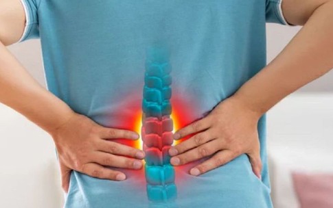 Gai cột sống có nguy hiểm không?