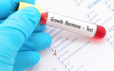 Trẻ thấp lùn do thiếu hụt hormone tăng trưởng