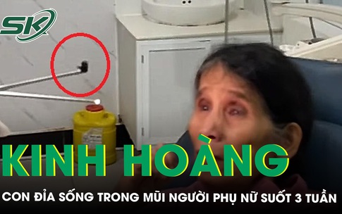 Kinh ho&#224;ng con đỉa sống trong mũi người phụ nữ suốt 3 tuần