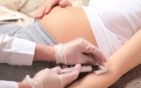 C&#225;c x&#233;t nghiệm s&#224;ng lọc trước sinh Hội chứng Down