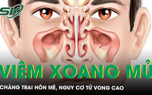 Sổ mũi v&#224;i ng&#224;y, ch&#224;ng trai h&#244;n m&#234;, nguy cơ tử vong cao 