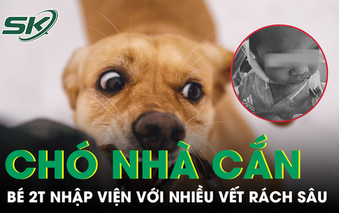 Tưởng ch&#243; nh&#224; v&#244; hại, b&#233; trai 2 tuổi bị cắn r&#225;ch mặt khi đang n&#244; đ&#249;a