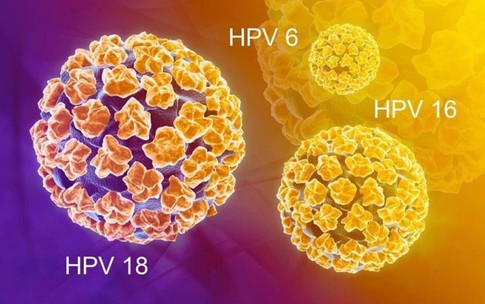 Chủng virus HPV n&#224;o dễ g&#226;y ung thư cổ tử cung nhất?
