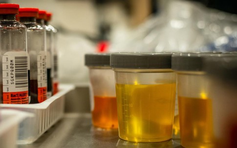 Tiểu ra m&#225;u c&#243; nguy hiểm kh&#244;ng?