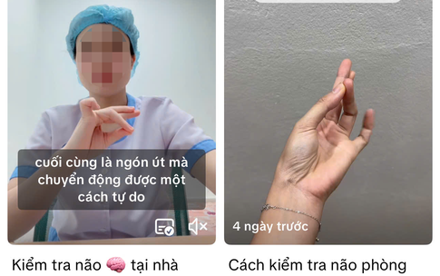 B&#225;c sĩ tim mạch giải đ&#225;p về clip hướng dẫn kiểm tra đột quỵ bằng ng&#243;n tay triệu view tr&#234;n mạng x&#227; hội