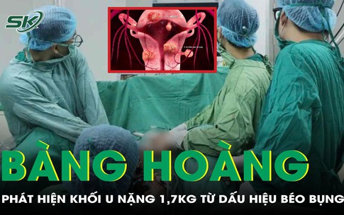 Tưởng b&#233;o bụng, đi kh&#225;m b&#224;ng ho&#224;ng ph&#225;t hiện khối u nặng 1.7kg, chiếm trọn ổ bụng