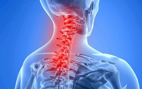 Đau cổ vai gáy có nguy hiểm, khi nào là bệnh lý phải nhập viện?
