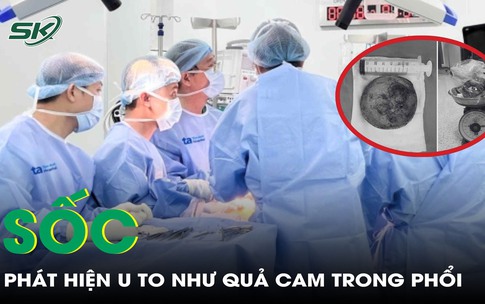 Sốc nặng khi ph&#225;t hiện khối u to như quả cam trong phổi