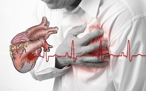 Biến chứng nguy hiểm của nhồi máu cơ tim