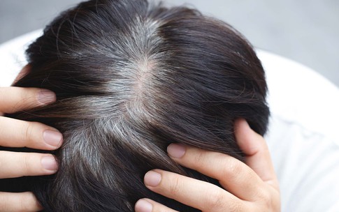V&#236; sao t&#243;c bạc sớm?