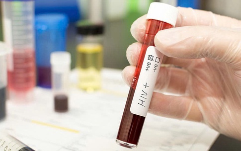 Ph&#225;t hiện HIV ở thai phụ khi chuyển dạ: Th&#225;ch thức v&#224; nguy cơ tiềm ẩn