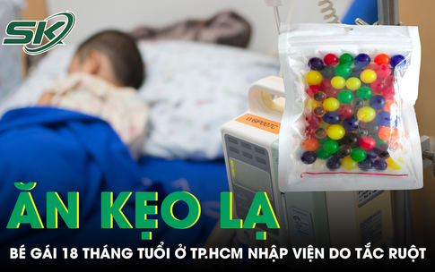 Ăn kẹo lạ, bé gái 18 tháng tuổi ở TP.HCM nhập viện do tắc ruột