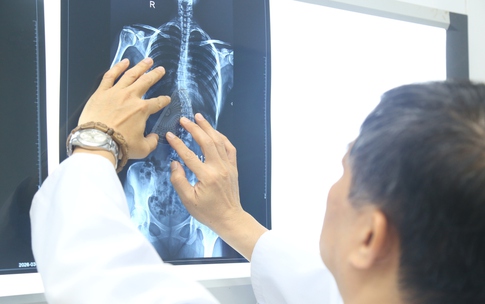 Nhiều trẻ chỉ được phát hiện bệnh khi cột sống đã cong vẹo, chuyên gia khuyến cáo gì đến phụ huynh?