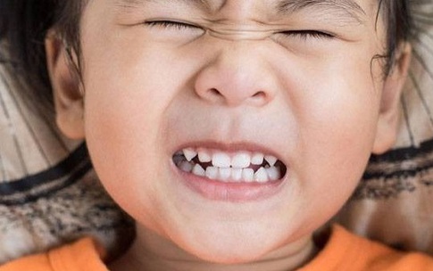 Răng cửa ngả vàng ở trẻ có ảnh hưởng gì đến sức khỏe?