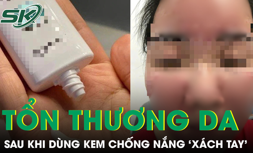 Nữ sinh bị tổn thương da nghiêm trọng sau khi dùng kem chống nắng SPF 70 ‘xách tay’