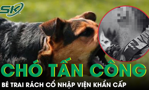 Bé trai bị chó nhà hàng xóm tấn công rách cổ, cảnh báo nguy cơ bệnh dại tăng cao dịp hè