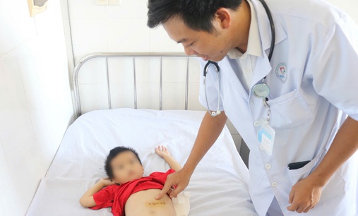Búi tóc nặng gần nửa cân nằm trong bụng bé trai 5 tuổi