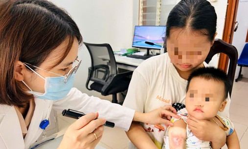 Viêm da do kiến ba khoang tăng ở Huế, cảnh báo việc tự chẩn đoán điều trị
