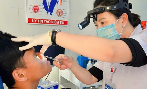 Chảy máu mũi 3 ngày, phát hiện đỉa sống ký sinh