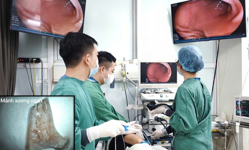 Người đàn ông cấp cứu sau bữa ngan luộc