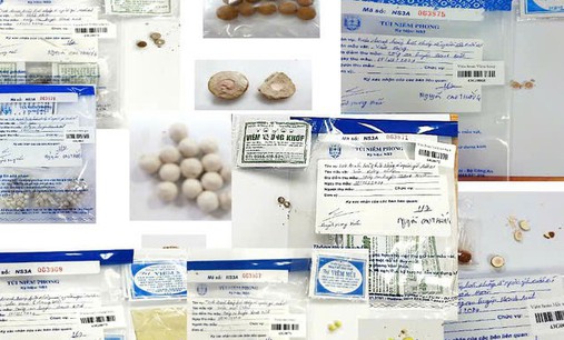Uống thuốc ‘gia truyền’ mua trên mạng, người đàn ông bị Gút cấp nặng