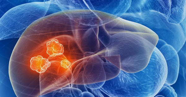 Có những loại bệnh gan nào có thể gây ra gan thô trên siêu âm?
