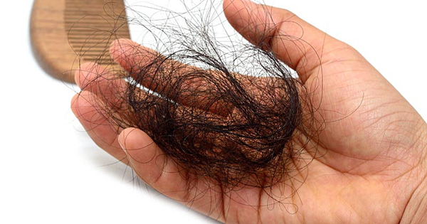 Bệnh da đầu tóc rụng có thể gây ra những tác động nghiêm trọng đến ngoại hình và sức khỏe không?
