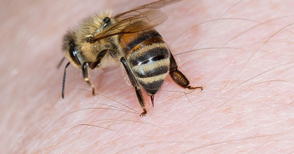 Bài thuốc ong bắp cày đốt bôi gì để giảm đau và viêm