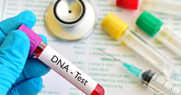 Làm thế nào để đo nồng độ DNA thai nhi và có cần phải thực hiện xâm lấn hay không?
