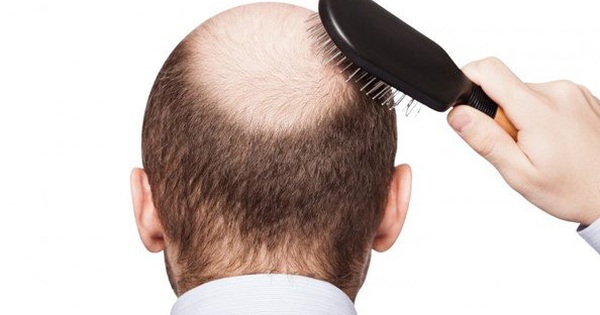 7 cách dễ dàng và không tốn kém giúp ngăn ngừa tình trạng rụng tóc và kích  thích mọc tóc cho cánh mày râu