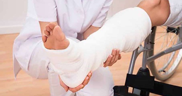  Phục hồi chức năng sau gãy xương cẳng chân - Những bước cần làm để hồi phục