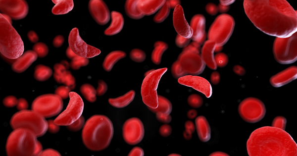 Những biến chứng nào có thể xảy ra do bệnh thiếu máu hồng cầu hình liềm?