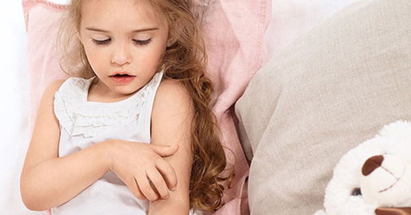 Dấu hiệu và cách chữa trị bệnh chàm ở trẻ em một cách tự nhiên