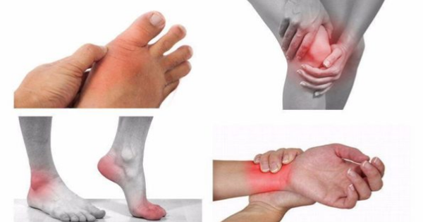 Có bao nhiêu loại thuốc trị đau nhức xương khớp tê bì chân tay?
